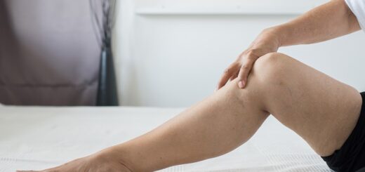 масло черного тмина варикоз